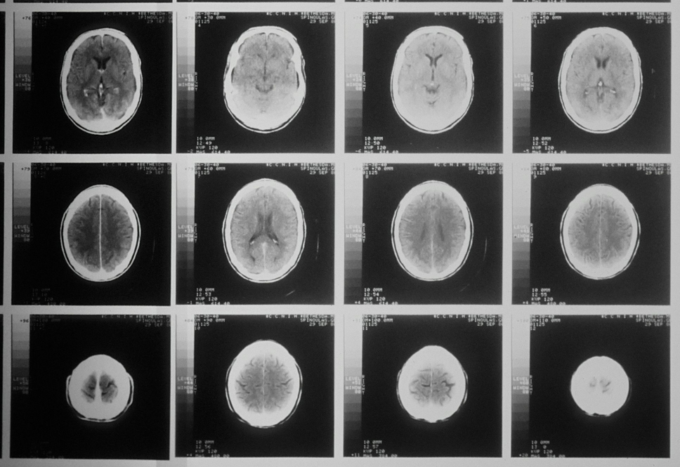 Bild: national-cancer-institute_TWIN-X Bild: national-cancer-institute_TWIN-X